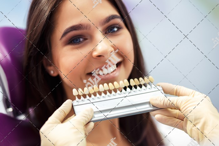معرفی دندان مصنوعی و لمینت دندان