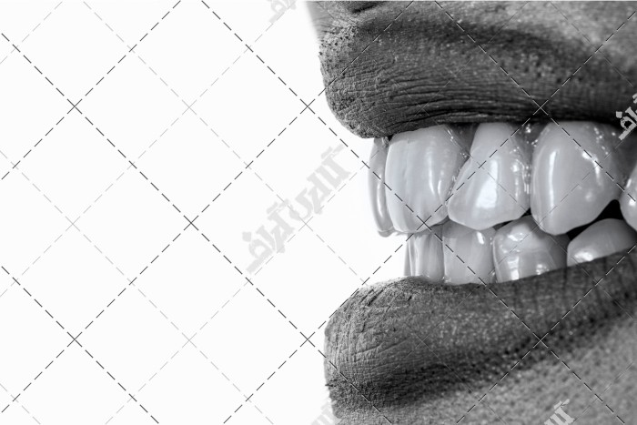 عکس لب و دهان زیبا و دندان های سفید