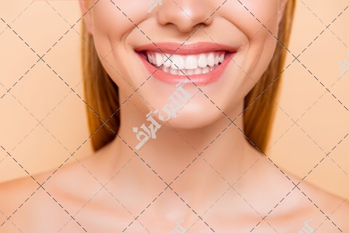 عکس لبخند زیبا و دندان های سفید