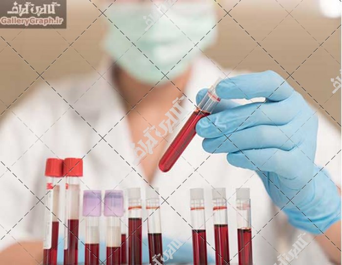 تصویر باکیفیت آزمایش خون