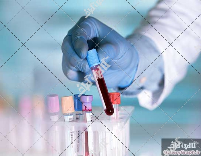 تصویر باکیفیت آزمایش خون، آزمایشگاه