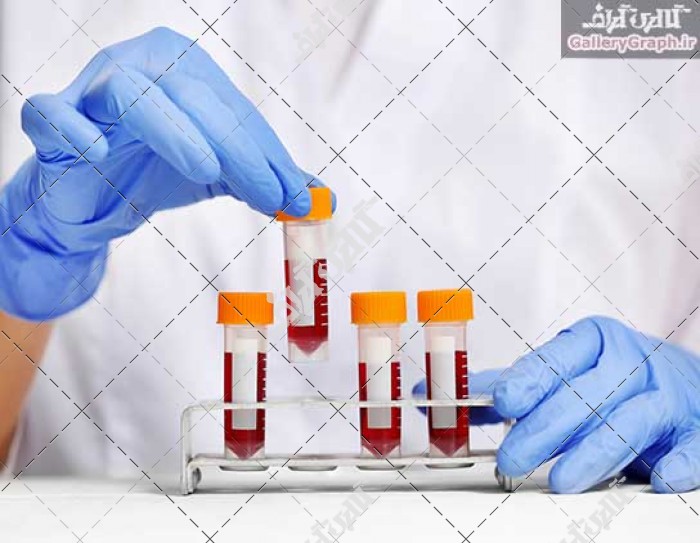 تصویر باکیفیت پزشک زن با نمونه خون در آزمایشگاه