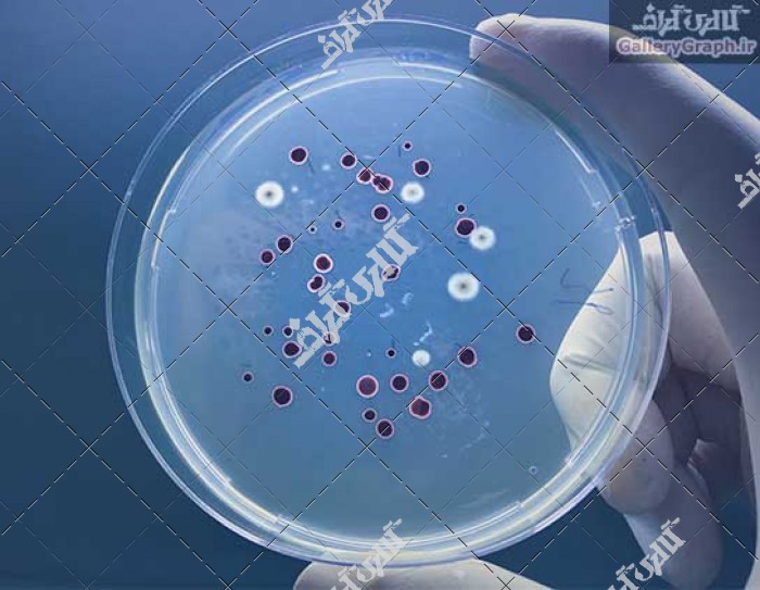 تصویر باکیفیت صفحه آگار پر از باکتری های میکروبی و میکروارگانیسم ها