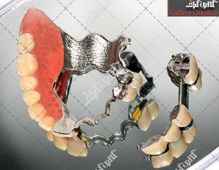 تصویر باکیفیت دندان مصنوعی 1