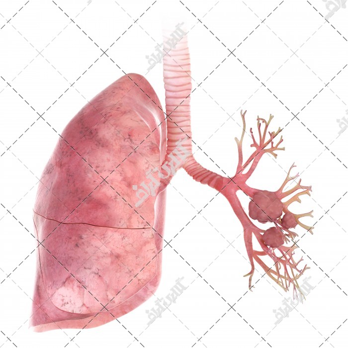 تصویر باکیفیت از ریه سرطانی