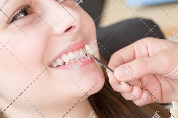 عکس روکش و پروتز دندان