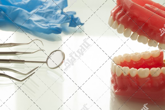 عکس قالب دندان