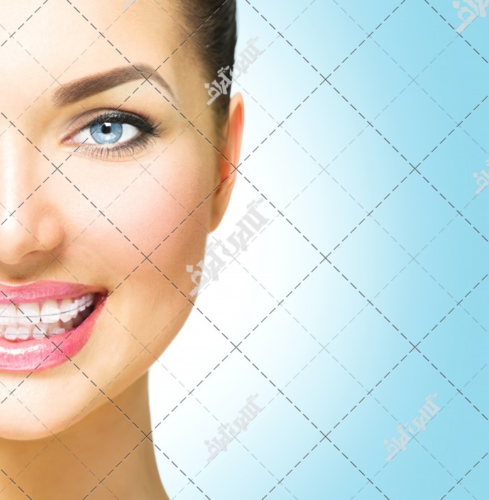 عکس ارتودنسی دندان مدل زن